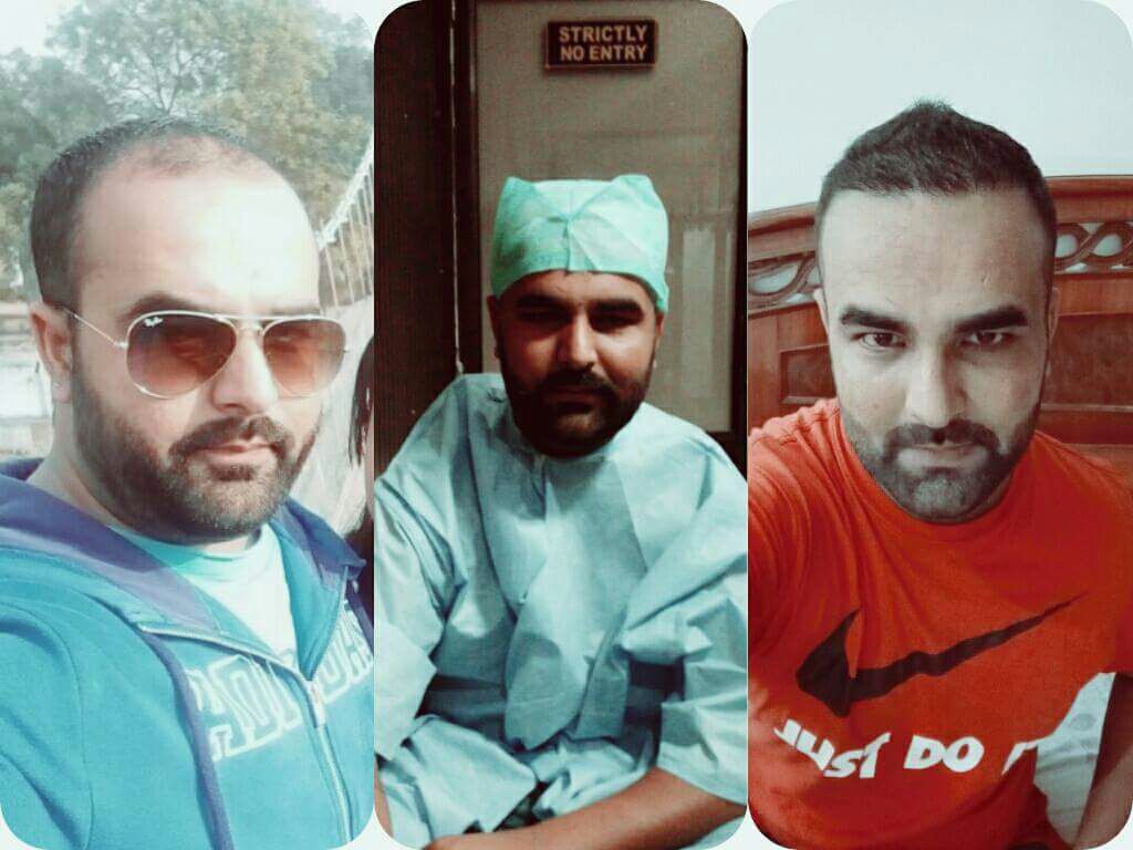 Garg Hair Transplant Clinic