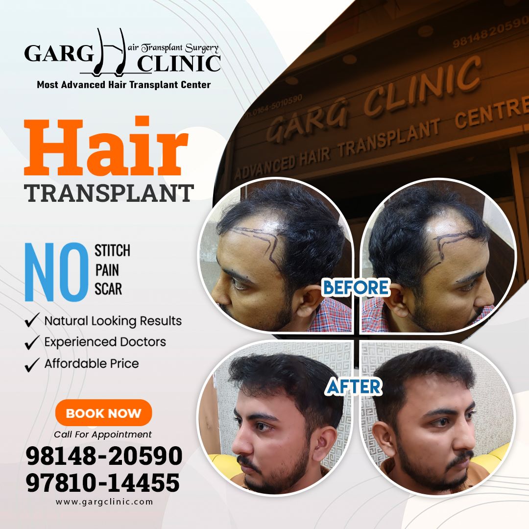Garg Hair Transplant Clinic